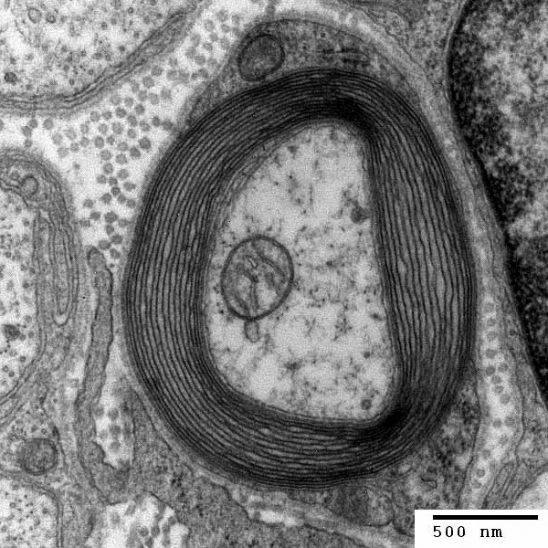 Transmission electron micrograph of a myelinated axon in cross section, with concentric dark myelin wraps around a pale axon core