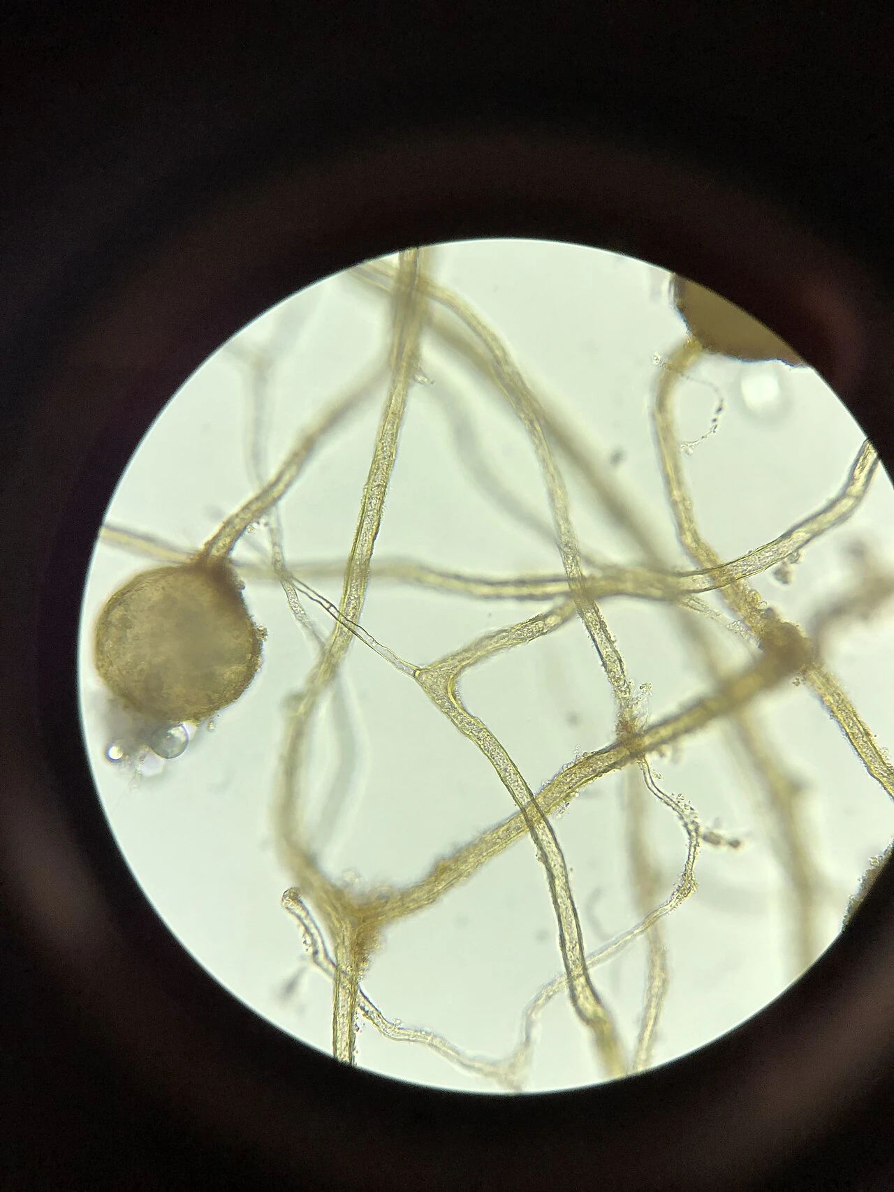 Mycorrhizal fungal hyphae under a microscope