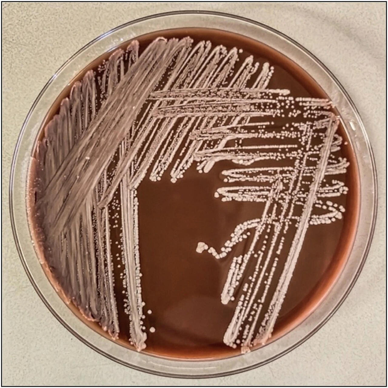 Streptomyces griseus, the soil bacterium that gave us streptomycin, on an agar plate