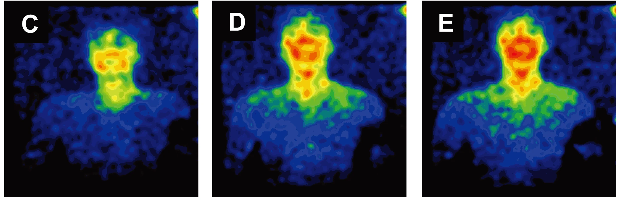 Three false-color images of ultraweak photon emission from a seated man's face and upper body at 10:10, 13:10 and 16:10, brightest around the mouth and cheeks